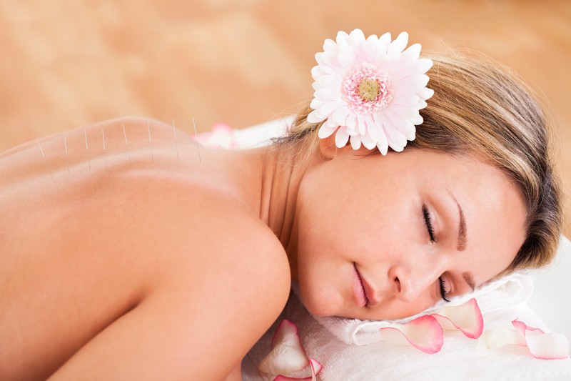 acupuncture